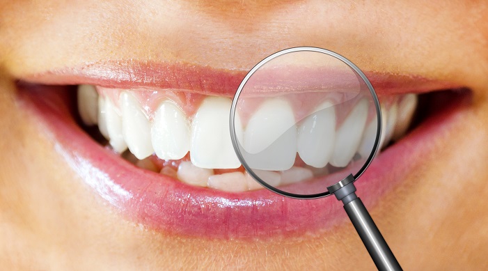 市販のホワイトニングで歯は白くなるのに、歯医者さんでやるのはお金の無駄使い！？