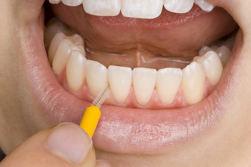 【衝撃】歯茎が臭い人の特徴が怖い！歯茎がにおう人、増えてます。