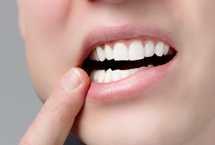 テトラサイクリンによる歯の黄ばみにはホワイトニングが効かない！？