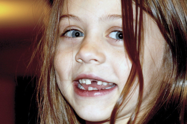 乳歯の歯並びについて。気になる７つの質問に歯科医師がお答えします！