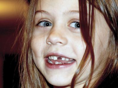 乳歯の歯並びについて。気になる７つの質問に歯科医師がお答えします！