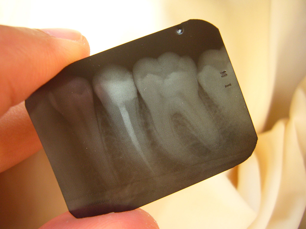 歯の大切な組織「象牙質」を知ることが、虫歯や知覚過敏対策の第一歩！