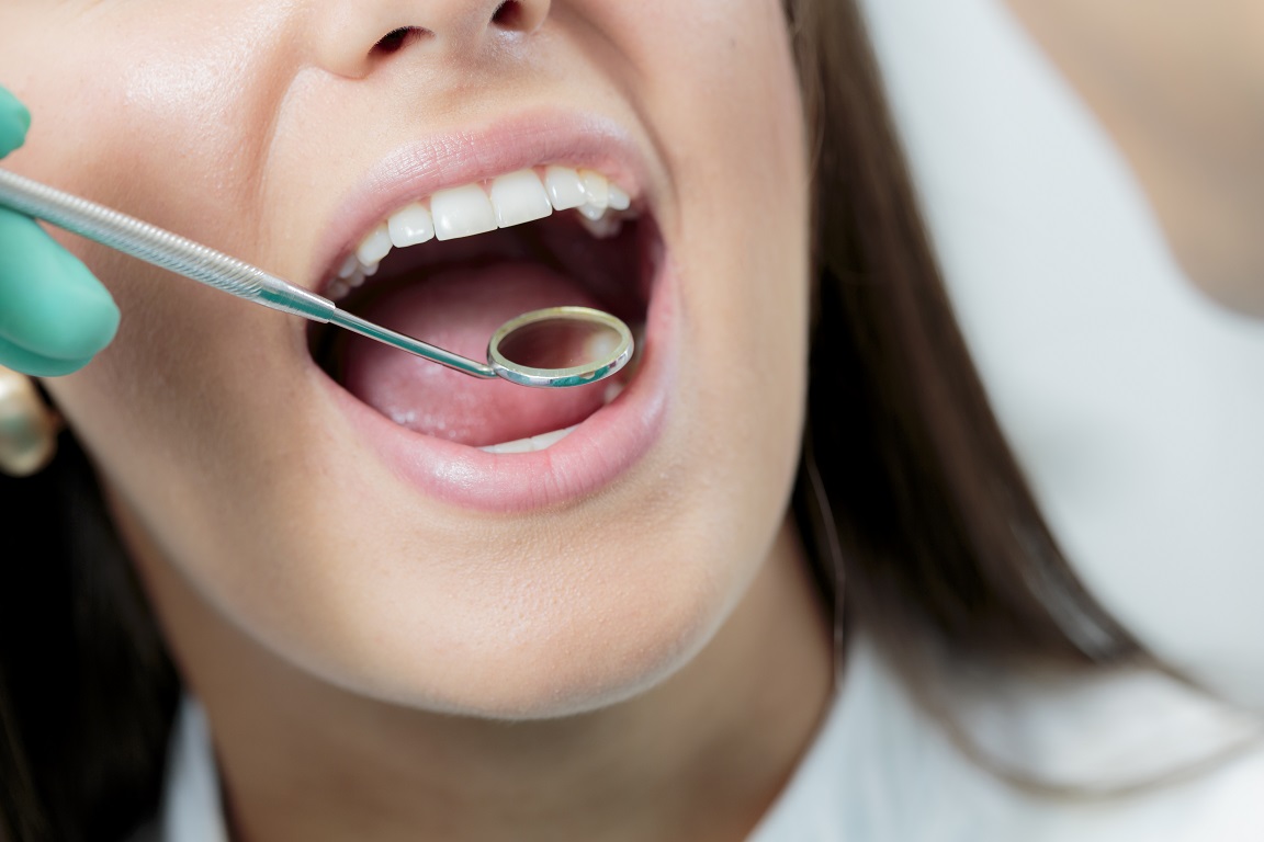 虫歯で歯に穴が空いている！アナタの虫歯の程度診断と、治療法について
