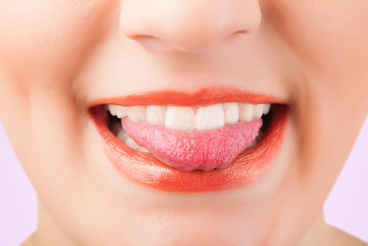 舌炎って何？症状と原因、主な治療法について