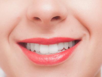 歯列矯正のために抜歯は必要？２つのケースと、抜く歯について。