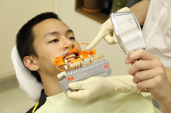 歯医者　ホワイトニング